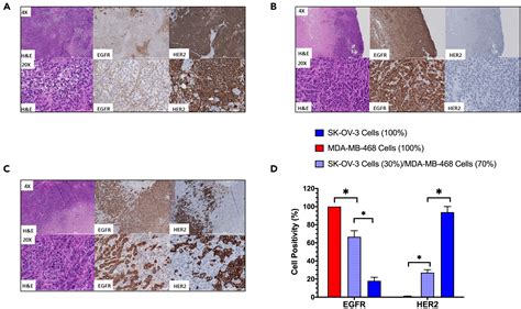 Bispecific Radioimmunoconjugates Exploit Receptor Heterogeneity For