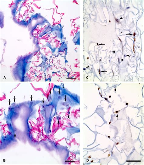 Photomicrographs Of Histological Sections From Integrated Implant