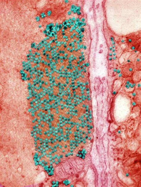 Coxsackie B Virus Particles Photograph By Ami Images Science Photo