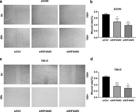 Knockdown Of Kif A Inhibits The Speeds Of Rcc Cells Wound Healing In