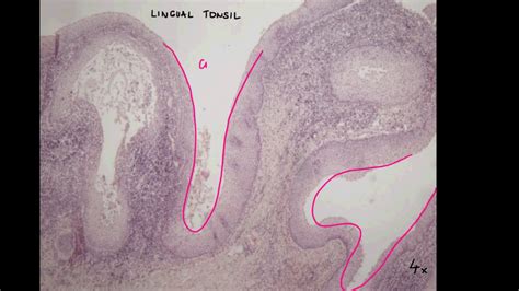 Lingual Tonsil Histology