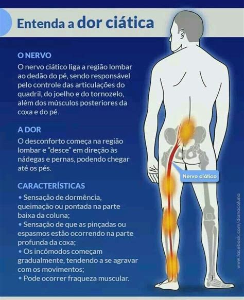 Dor Ciática Exercícios Para Nervo Ciático Dor Ciática E Nervo Ciático