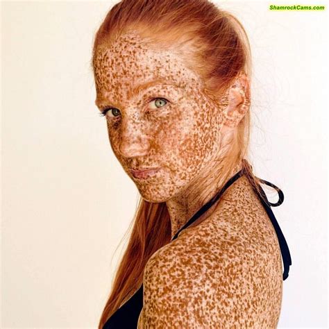 Freckles Beauty Freckled Freckles Girl Redheads Redheads Freckles