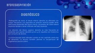 Broncoaspiracion Pptx