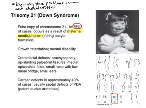 MCM Congenital Anomalies Flashcards Quizlet