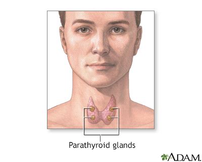 Parathyroid hyperplasia Information | Mount Sinai - New York