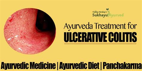 Fighting Ulcerative Colitis With Ayurvedic Treatment