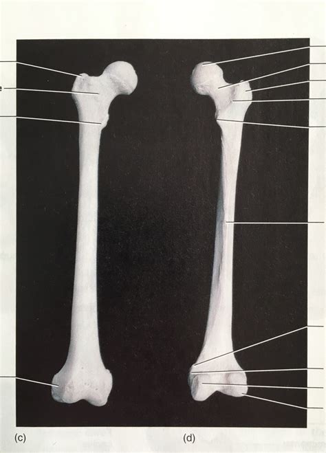 Right Femur Anterior And Posterior View Real Diagram Quizlet