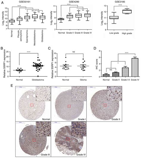 Ssrp1 Silencing Inhibits The Proliferation And Malignancy Of Human