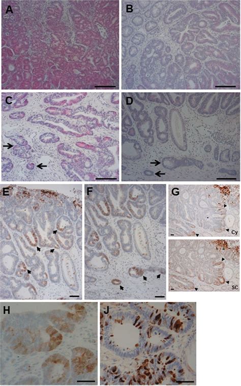 Histological Features Of CLys Cox 2 X Apc Min Mouse Colonic Tumours