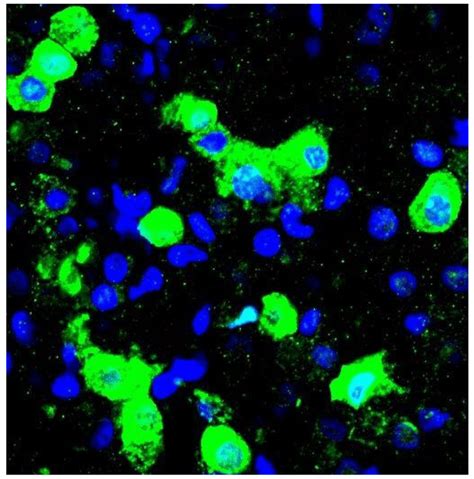 Morphology And Protein Expression Of Adult Human Alveolar Type Ii