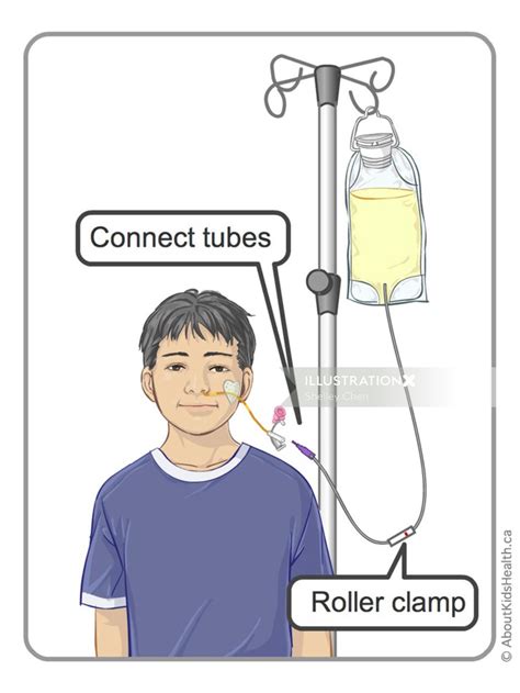 Ng Tube Feeding Bag Illustration By Shelley Chen Off