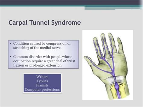 Carpal tunnel symptoms - jokerwar