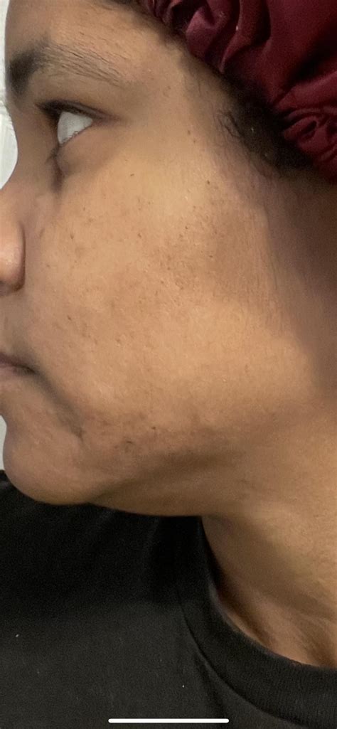 Is there even a difference?? 2nd month recently started. Dose doubled