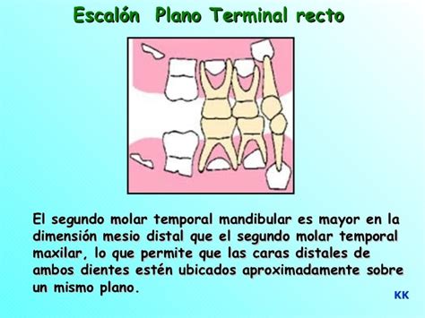 Unidad Guía De Erupción