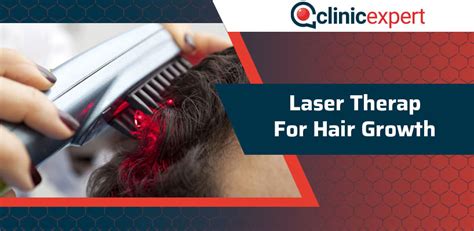 Laser Therapy for Hair Growth | ClinicExpert