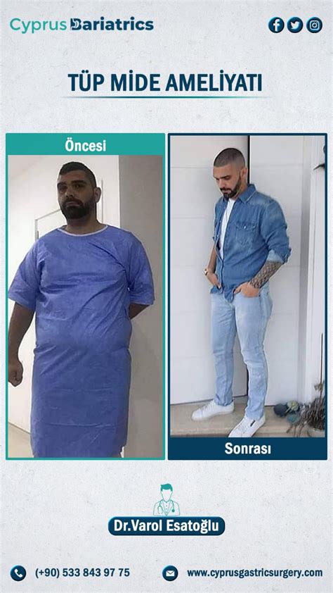 Kıbrıs Obezite Tedavi Merkezi Dr Varol Esatoğlu Kıbrıs Obezite