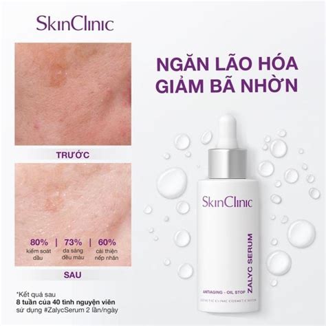 HƯỚNG DẪN CÁCH CHỌN ĐÚNG SERUM CHO DA DẦU MỤN SkinClinic Vietnam