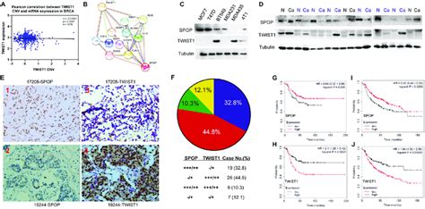 Expression Of Spop And Twist1 Is Reversely Correlated With Invasive