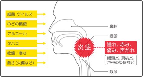 のど（喉）が痛くなった時の原因別対処法 Vicks 大正製薬