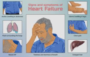 ACE Inhibitors: Congestive Heart Failure - Physiopedia