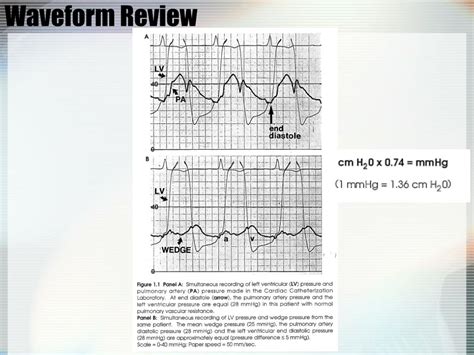 PPT Hemodynamic Monitoring In The CCU PowerPoint Presentation Free