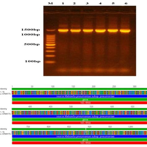 A Gel Electrophoresis Of Pcr Product With 1500 Bp Of 16s Rrna Gene In