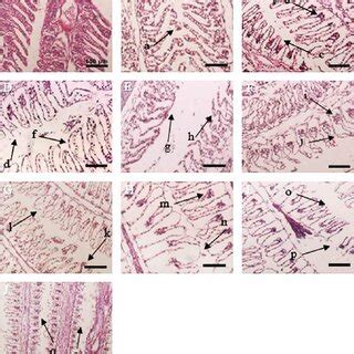 Grading Of Histopathological Changes Observed In Liver Tissues