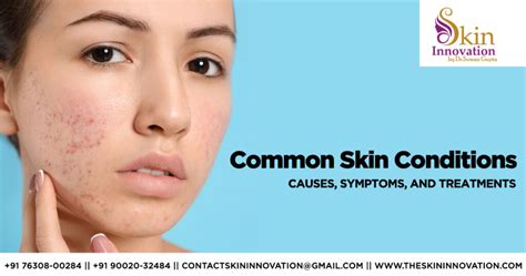 Knowing the Causes, Symptoms, and Treatments of Common Skin Conditions