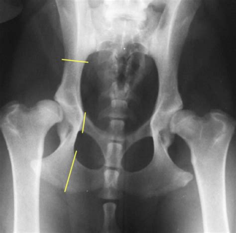 Orthopaedic Conditions Of The Hip Part 2 Flashcards Quizlet