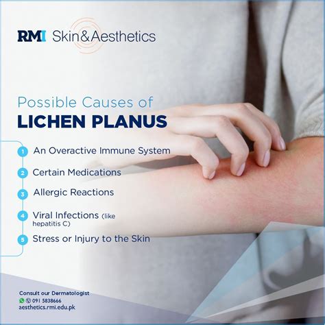 Lichen Planus: Causes, Symptoms, and How to Manage | Rehman Medical
