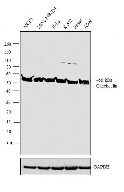 Calreticulin Polyclonal Antibody Pa1 903