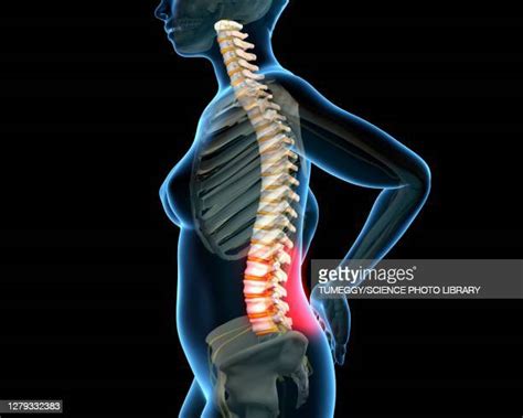 342 Spine Discs Stock Photos High Res Pictures And Images Getty Images