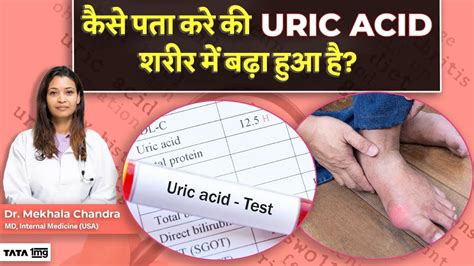 Uric Acid क्या होता है इसके बढ़ने से क्या खतरा है What Is Uric Acid Joint Pain Tata 1 Mg