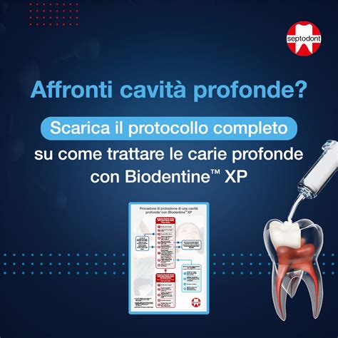 Protocollo di restauro delle cavità profonde Septodont Italia