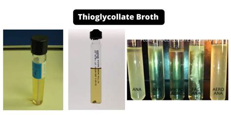 Thioglycollate Broth - Composition, Principle, Preparation, Results ...