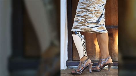 Designer prosthetic legs | CNN