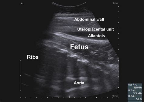 The Equine Fetal Thorax Imaged With A 3 5 MHz Macroconvex Ultrasound