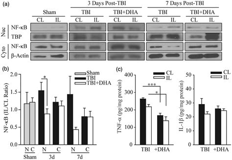 Administration Of Dha Reduces Endoplasmic Reticulum Stress Associated