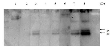 Representative figure indicating results of the immunoblotting analysis ...