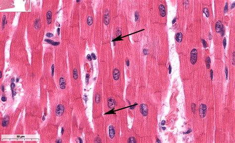 Histologia Del Miocardio M Sculo Cardiaco Explicaci N F Cil