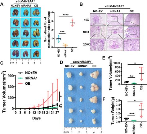 CircCAMSAP1 Promotes Proliferation And Metastasis Of NPC Cells In