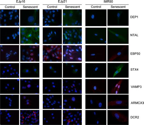 Expression And Localization Of Senescence Markers Immunofluorescent