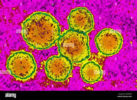 Virus De La Rubéola Fotos e Imágenes de stock Alamy