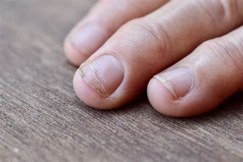 16 Disturbing Things Your Nails Reveal About Your Health Facty Health