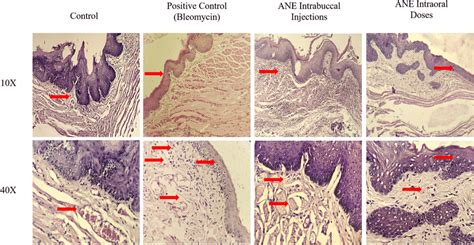 Photomicro Graphical Presentation Of Histological Changes Associated