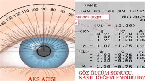 Sph Hoya Vision