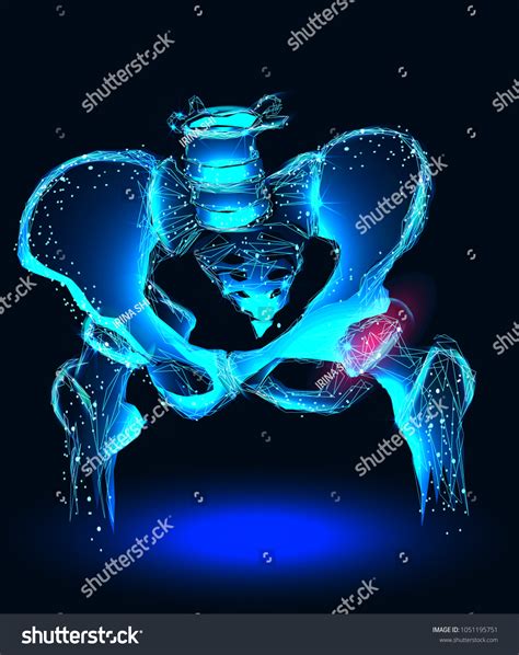 Arthritis Hip Joint Inflamed Hip Joint Stock Vector (Royalty Free
