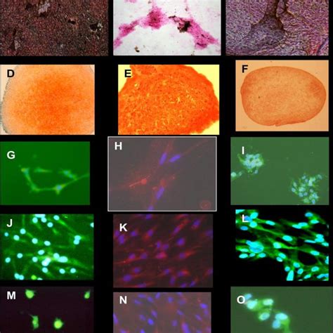 Expressions of osteoblast markers by real-time reverse... | Download ...