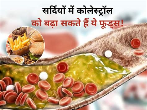 Cholesterol Levels Are Highest In Winter सर्दियों में दोगुनी रफ्तार से बढ़ सकता है कोलेस्ट्रॉल